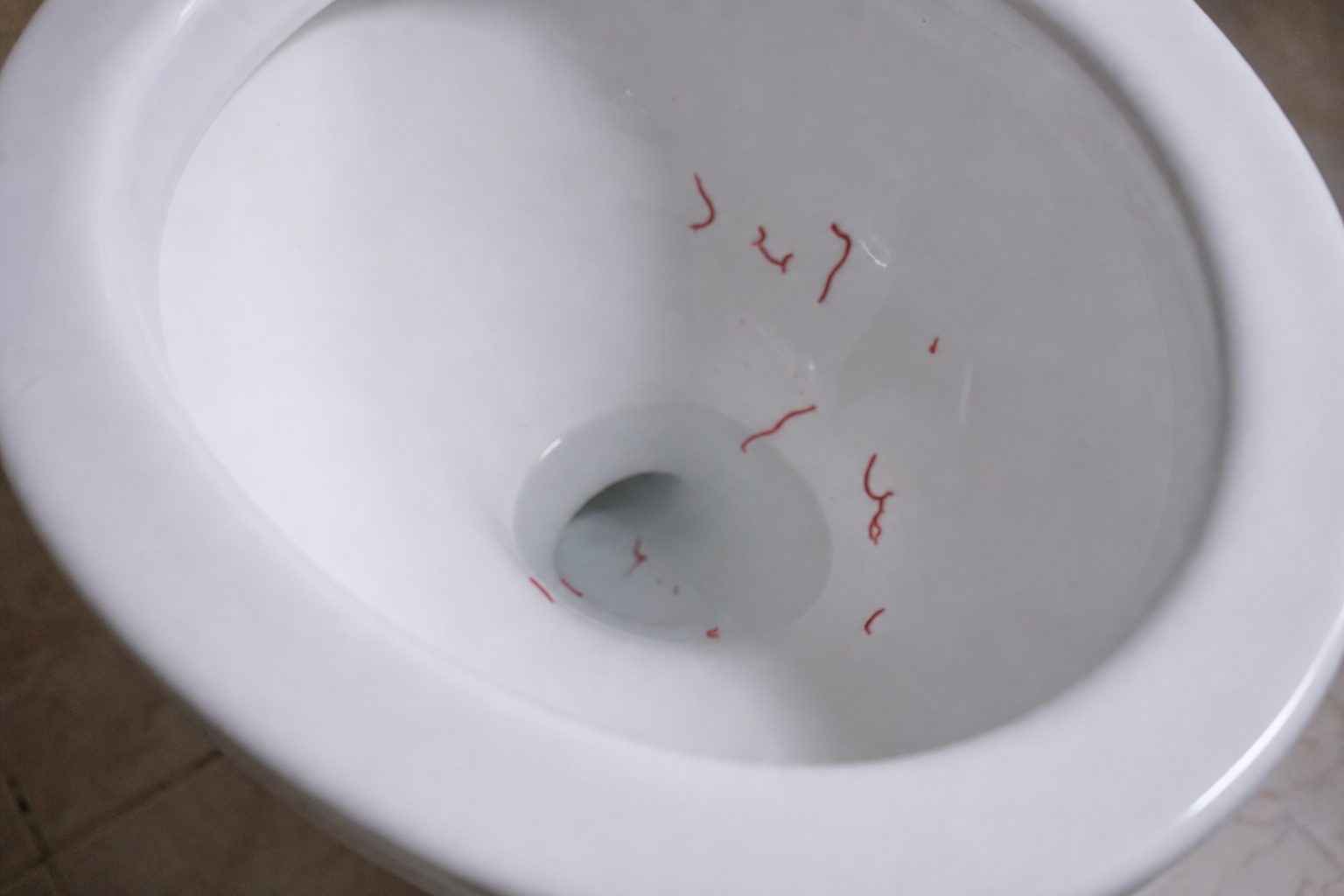 Pourquoi trouve-t-on des vers rouges dans les toilettes ?
